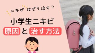 小学生のニキビの原因と治す方法｜ママができる正しい対処法