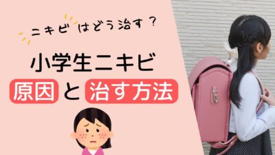 小学生のニキビの原因と治す方法｜ママができる正しい対処法